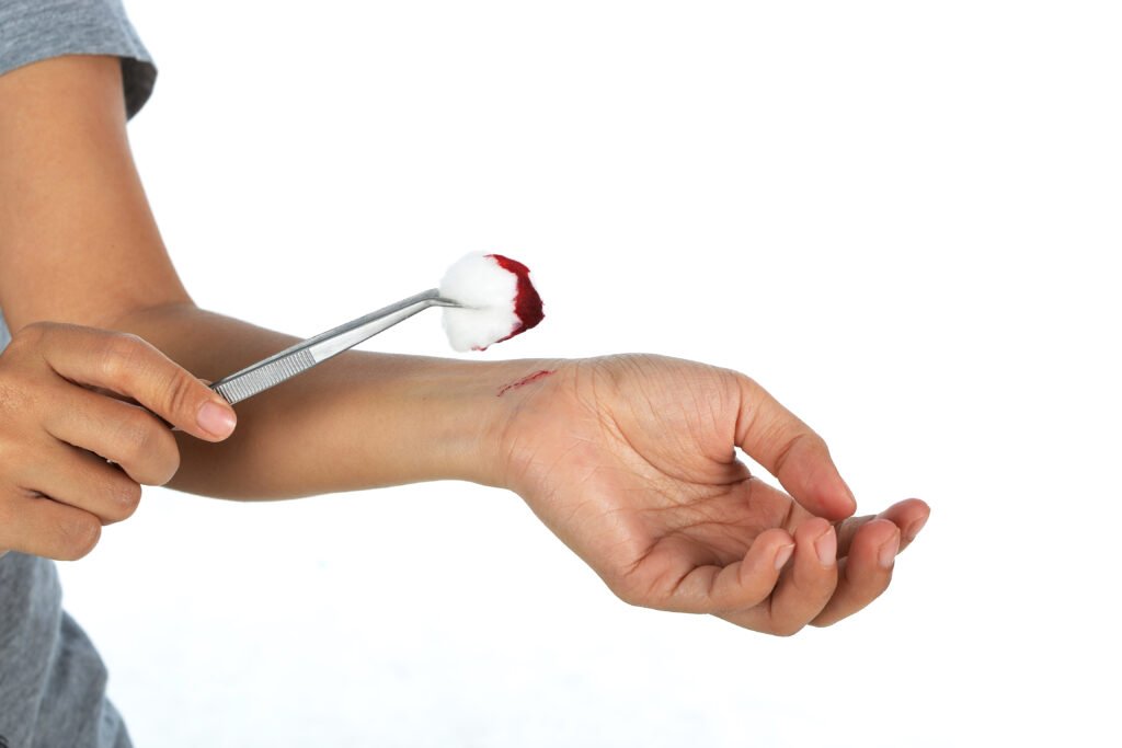 Traditional Bandages