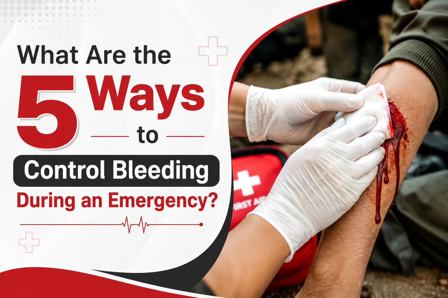 5 ways to control bleeding