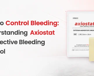 How to Control Bleeding