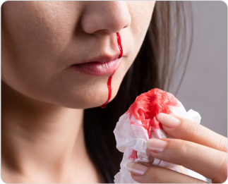 Why Bleeding Control Should Be Part of Every First Aid Kit